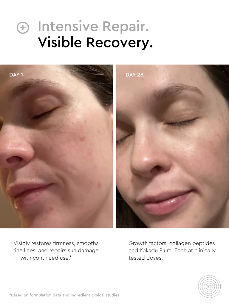 skin recovery cream