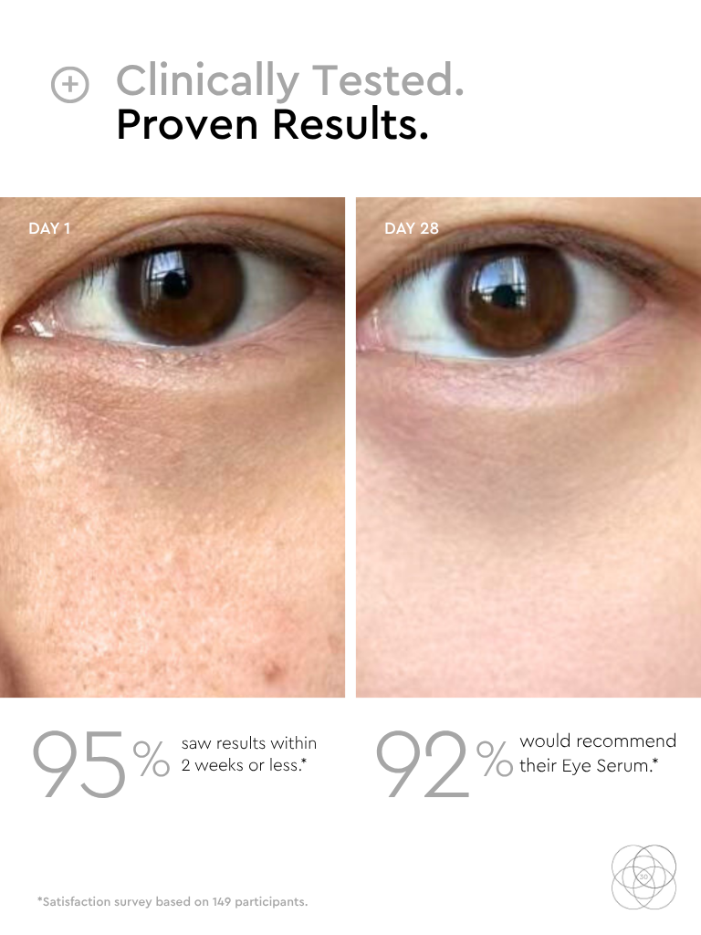 rejuvaus eye serum results