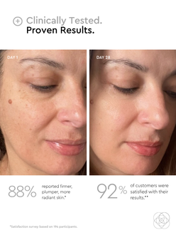 firmer and plumper skin