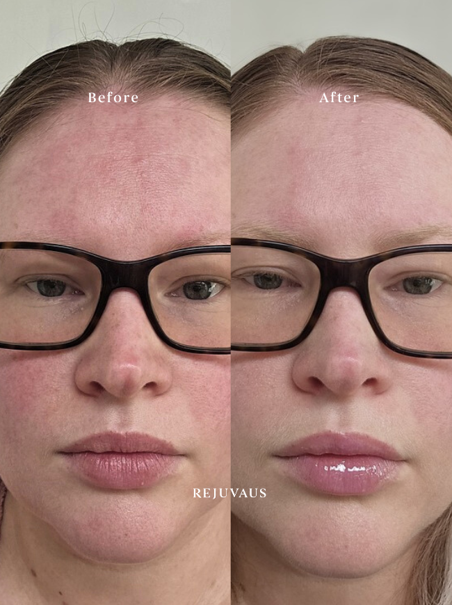 Before & After Niacinamide Serum