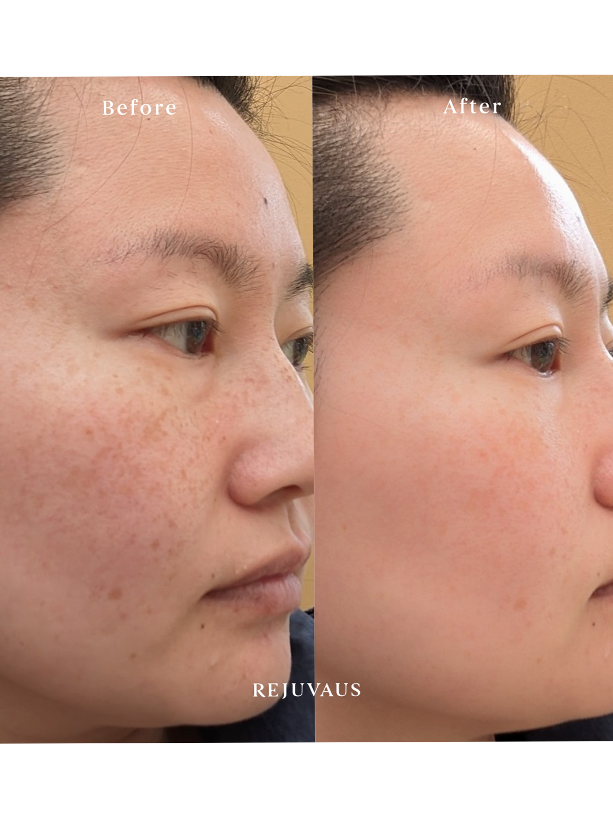 Before & After Retinol Serum